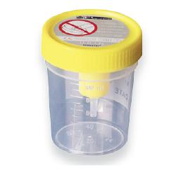 CONTENITORE URINA STERILE MEDIPRESTERIL CON SISTEMA TRANSFERT PER PROVETTE SOTTOVUOTO - Angeli Pharm