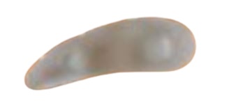 CUSCINETTO ORIONE G114 3 ANELLI PER DITA A MARTELLO DESTRO MISURA UNICA - Angeli Pharm